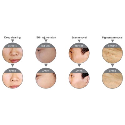 MegaOXY Next Generation -Urządzenia wielofunkcyjne- 