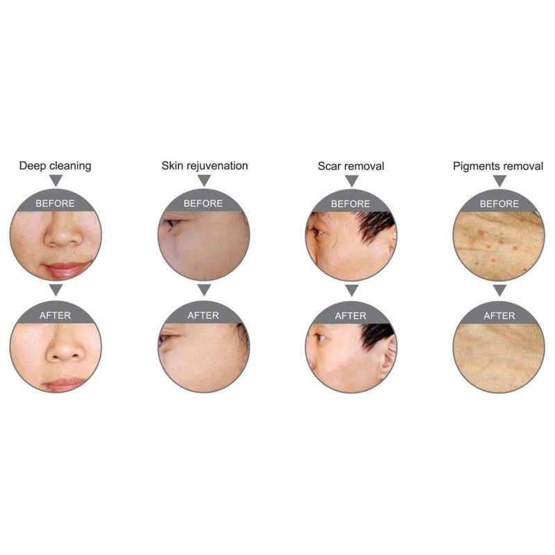 MegaOXY Next Generation -Urządzenia wielofunkcyjne- 